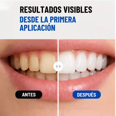 Sonrisa Blanca